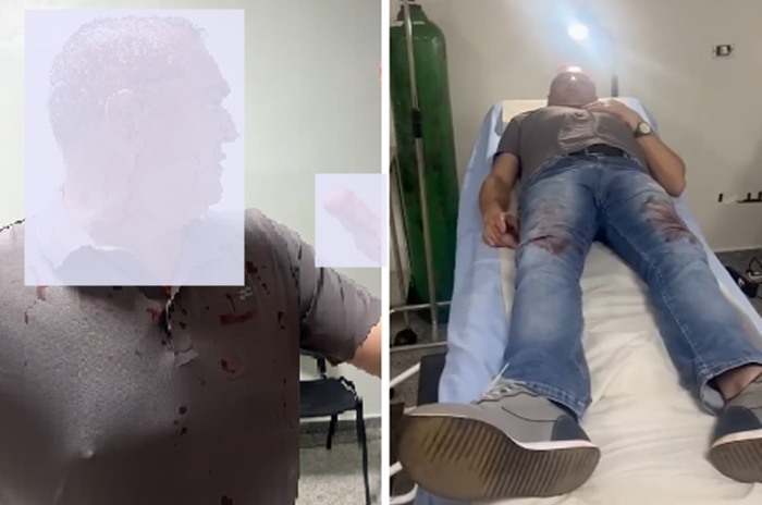  Prefeito de Palmital/PR leva uma “cadeirada” na cabeça em um bairro da cidade durante a madrugada